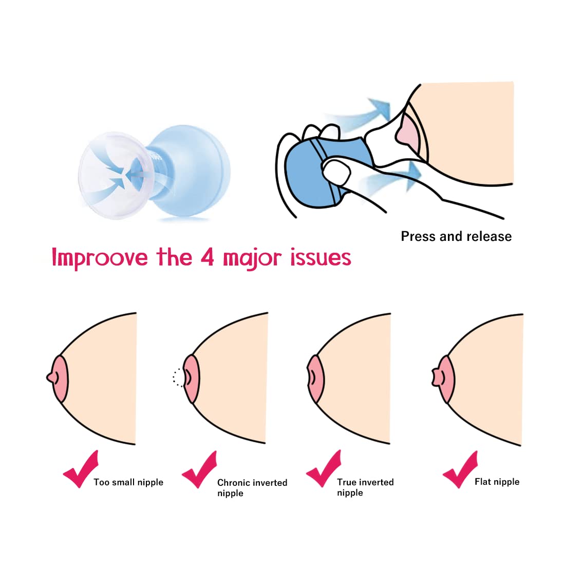 Adore Nipple Puller with Anti bacterial Storage Case- Yellow